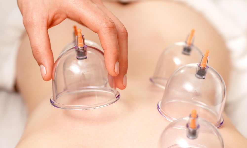 cupping therapy singapore