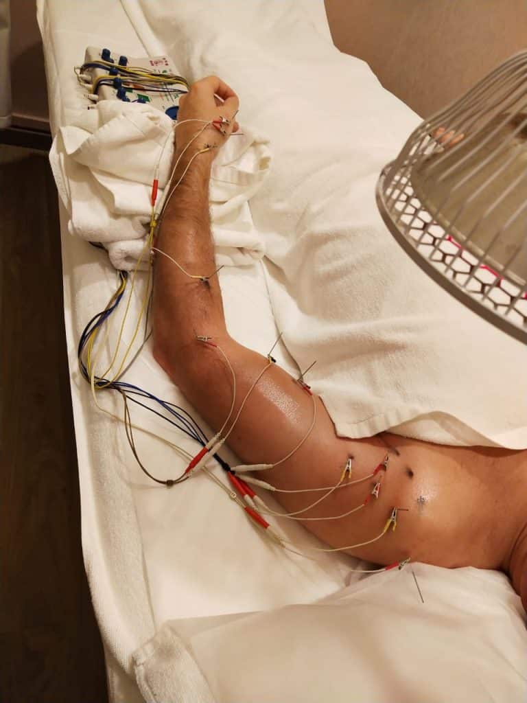 Meridian vibration therapy