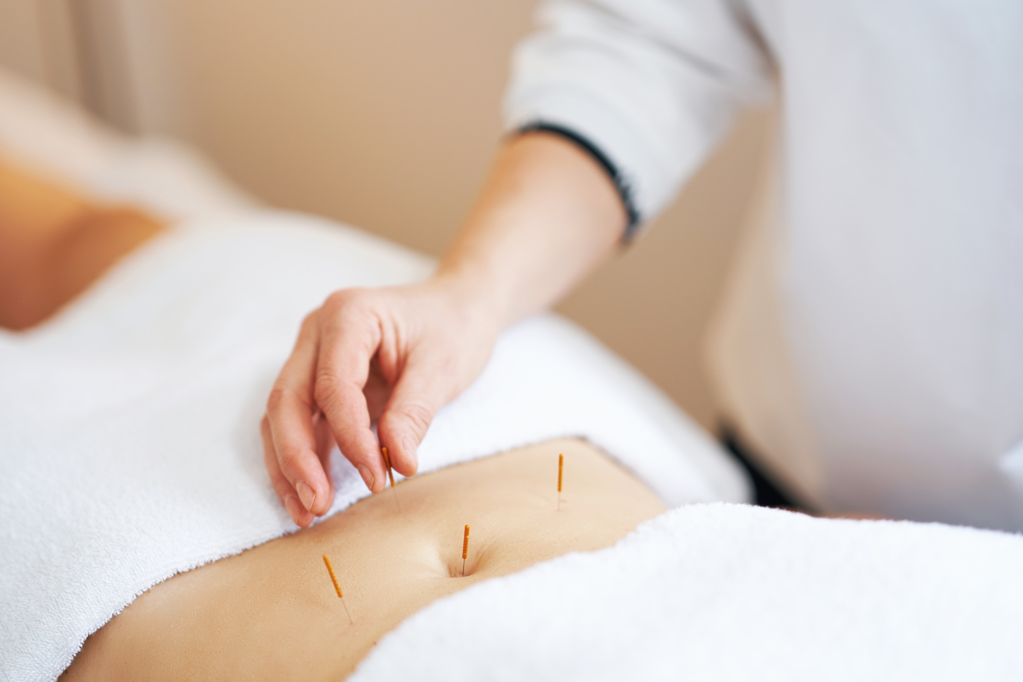 best acupuncture clinic in Singapore