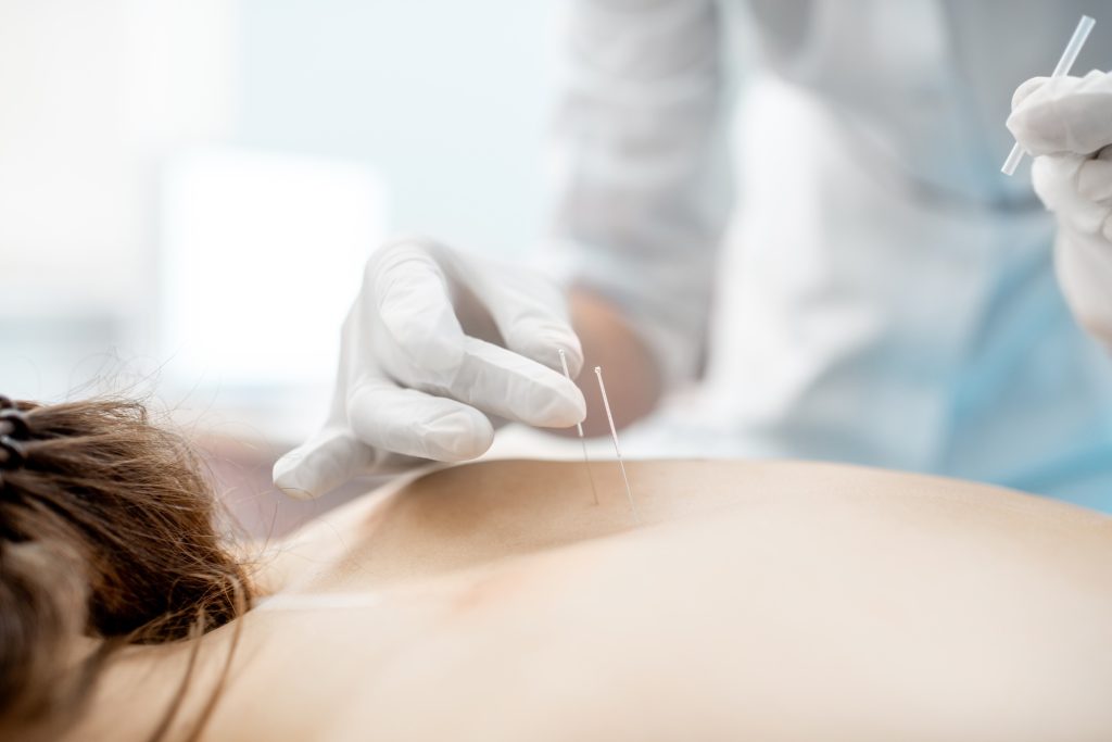 acupuncture maternity